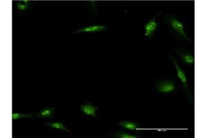 Immunofluorescence of monoclonal antibody to HEXIM1 on HeLa cell.
