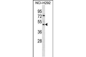 Western blot analysis in NCI-H292 cell line lysates (35ug/lane). (GP2 anticorps  (N-Term))