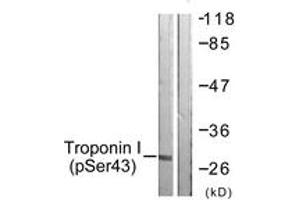 Western blot analysis of extracts from Jurkat cells, using TNNI3 (Phospho-Ser43) Antibody. (TNNI3 anticorps  (pSer43))