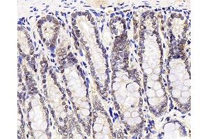 Immunohistochemistry analysis of paraffin-embedded rat stomach node using MGMT Polyclonal Antibody at dilution of 1:300.