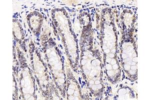 Immunohistochemistry analysis of paraffin-embedded rat stomach node using MGMT Polyclonal Antibody at dilution of 1:300. (MGMT anticorps)