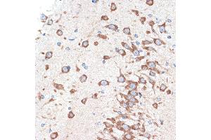 Immunohistochemistry of paraffin-embedded rat brain using  Rabbit mAb (ABIN7265453) at dilution of 1:100 (40x lens). (ADORA1 anticorps)