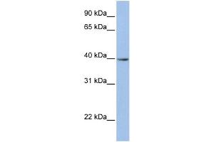 WB Suggested Anti-ZNF202 Antibody Titration:  0. (ZNF202 anticorps  (N-Term))