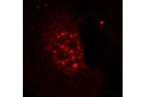 Image no. 3 for anti-V-Akt Murine Thymoma Viral Oncogene Homolog 1 (AKT1) (pThr308) antibody (ABIN196710) (AKT1 anticorps  (pThr308))