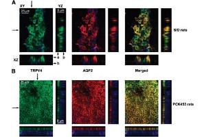 Multiplex staining of Aquaporin 2 and TRPV4 in rat kidney.