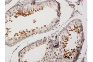 Immunoperoxidase of purified MaxPab antibody to SPA17 on formalin-fixed paraffin-embedded human testis.