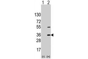 Western blot analysis of SSR1 (arrow) using SSR1 polyclonal antibody . (SSR1 anticorps  (N-Term))