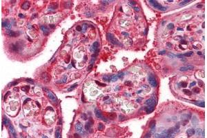 Human Placenta: Formalin-Fixed, Paraffin-Embedded (FFPE)