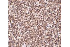 Immunohistochemistry of TREX1 in human spleen tissue with this product at 2. (TREX1 anticorps  (Center))