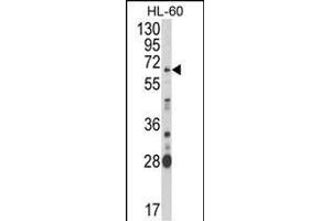 Western blot analysis of ARSB Antibody (Center) (ABIN652346 and ABIN2841582) in HL-60 cell line lysates (35 μg/lane). (Arylsulfatase B anticorps  (AA 235-266))