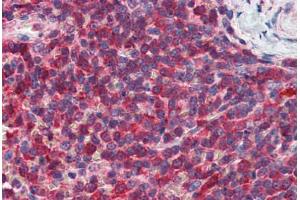 Human Spleen: Formalin-Fixed, Paraffin-Embedded (FFPE)