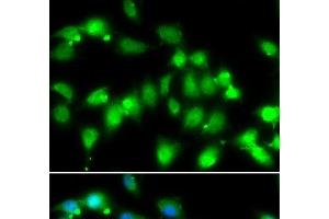 Immunofluorescence analysis of HeLa cells using AKAP5 Polyclonal Antibody at dilution of 1:100. (AKAP5 anticorps)