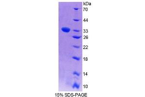 SDS-PAGE analysis of Mouse PCYOX1 Protein. (PCYOX1 Protéine)