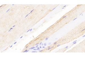 Detection of NMU in Rat Skeletal muscle Tissue using Polyclonal Antibody to Neuromedin U (NMU)