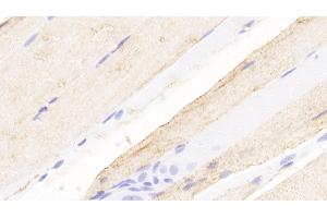 Detection of NMU in Rat Skeletal muscle Tissue using Polyclonal Antibody to Neuromedin U (NMU) (Neuromedin U anticorps  (AA 38-174))