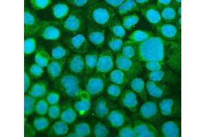 IF analysis of ICAM1 using anti-ICAM1 antibody (ABIN5692991). (ICAM1 anticorps  (AA 28-268))