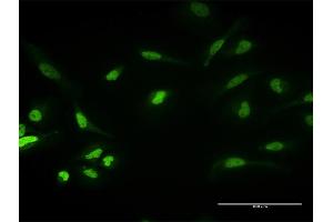 Immunofluorescence of purified MaxPab antibody to PKNOX1 on HeLa cell. (PKNOX1 anticorps  (AA 1-436))