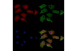 ABIN6264247 and ABIN6269325 staining HepG2 cells by IF/ICC. (PKC zeta anticorps  (C-Term))