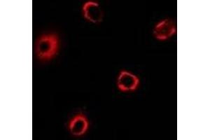 Immunofluorescent analysis of BRCC2 staining in MCF7 cells.