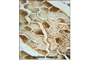 Immunohistochemistry analysis in Formalin Fixed, Paraffin Embedded Human skeletal muscle stained with SAR1B antibody (Center) followed by peroxidase conjugation of the secondary antibody and DAB staining.