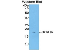 Western blot analysis of the recombinant protein. (IL1A anticorps  (AA 111-204))