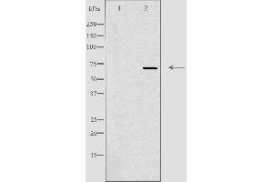 Western blot analysis of extracts from Jurkat cells using ADCK2 antibody.