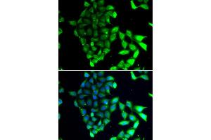Immunofluorescence analysis of MCF-7 cells using MID1 antibody (ABIN5974393). (MID1 anticorps)