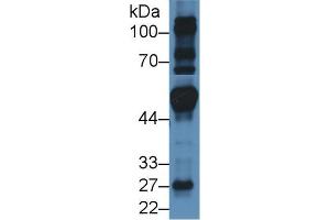 Western blot analysis of Mouse Heart lysate, using Human FRS2 Antibody (3 µg/ml) and HRP-conjugated Goat Anti-Rabbit antibody ( (FRS2 anticorps  (AA 239-449))