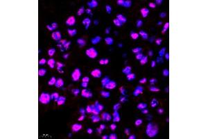 Immunofluorescence of paraffin embedded rat placenta using SMNDC1 (ABIN7075773) at dilution of 1:650 (400x lens)