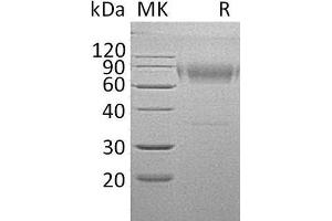 Western Blotting (WB) image for Interleukin 18 Binding Protein (IL18BP) protein (Fc Tag) (ABIN7320579)
