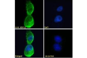 ABIN570879 Immunofluorescence analysis of paraformaldehyde fixed U2OS cells, permeabilized with 0. (Ataxin 2 anticorps  (Internal Region))