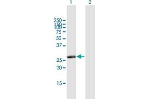 Western Blot analysis of RASSF3 expression in transfected 293T cell line by RASSF3 MaxPab polyclonal antibody. (RASSF3 anticorps  (AA 1-238))
