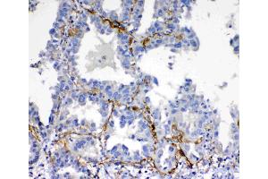 IHC analysis of VEGFD using anti-VEGFD antibody .