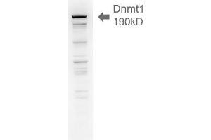 Dnmt1, 18ug H1299 lysate 1 in1000 Western Blotting. (DNMT1 anticorps  (AA 637-650))