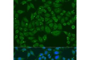 Immunofluorescence analysis of U2OS cells using INPP5K Polyclonal Antibody at dilution of 1:100.