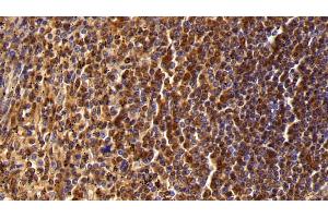 Detection of CD45 in Human Spleen Tissue using Polyclonal Antibody to Protein Tyrosine Phosphatase Receptor Type C (CD45)