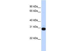 WB Suggested Anti-VASH1 Antibody Titration: 0.