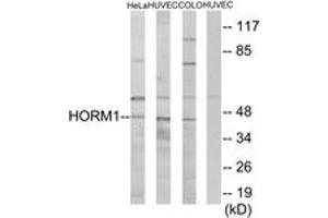 Western Blotting (WB) image for anti-HORMA Domain Containing 1 (HORMAD1) (AA 321-370) antibody (ABIN2889660) (HORMAD1 anticorps  (AA 321-370))