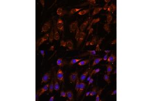 Immunofluorescence analysis of C6 cells using FARSB antibody (ABIN7269267) at dilution of 1:100.