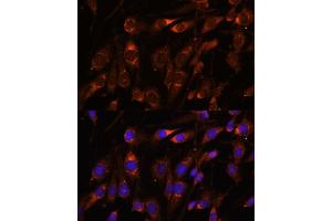 Immunofluorescence analysis of C6 cells using FARSB antibody (ABIN7269267) at dilution of 1:100. (FARSB anticorps  (AA 240-589))