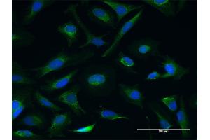 Immunofluorescence of purified MaxPab antibody to CETN3 on HeLa cell. (CETN3 anticorps  (AA 1-167))