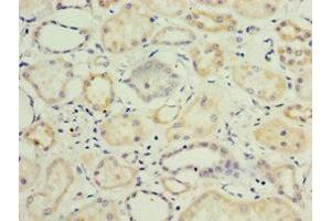 Immunohistochemistry of paraffin-embedded human kidney tissue using ABIN7157726 at dilution of 1:100 (KLF3 anticorps  (AA 1-240))
