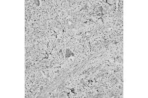 IHC on rat brain (paraffin sections) using Rabbit antibody to RhoA   at a concentration of 15 µg/ml, incubated overnight and developed with DAB Ni.