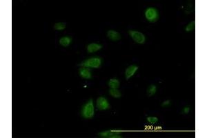 Image no. 4 for anti-CDK5 Regulatory Subunit Associated Protein 3 (CDK5RAP3) (AA 1-507) antibody (ABIN599311) (CDK5RAP3 anticorps  (AA 1-507))