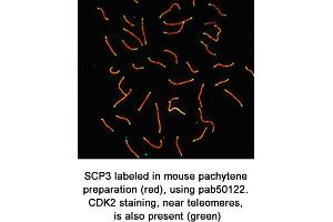 Image no. 1 for anti-Synaptonemal Complex Protein 3 (SYCP3) (C-Term) antibody (ABIN363431) (SYCP3 anticorps  (C-Term))