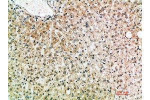 Immunohistochemical analysis of paraffin-embedded human-liver, antibody was diluted at 1:200 (IL-19 anticorps  (AA 51-100))