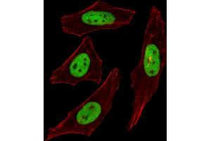 Fluorescent image of Hela cells stained with SUMO2/3 Antibody (C-term) (ABIN388034 and ABIN2845512). (SUMO2/3 anticorps  (C-Term))