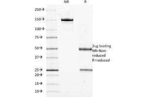 SDS-PAGE Analysis of Purified, BSA-Free Cytokeratin 18 Antibody (clone DE-K18). (Cytokeratin 18 anticorps)
