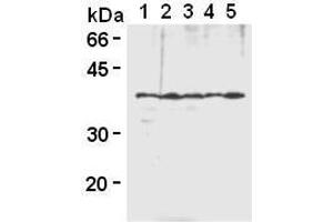Western Blotting (WB) image for anti-Heterogeneous Nuclear Ribonucleoprotein A2/B1 (HNRNPA2B1) antibody (ABIN1449240) (HNRNPA2B1 anticorps)