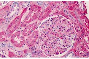 Human Kidney: Formalin-Fixed, Paraffin-Embedded (FFPE) (APOA1 anticorps)